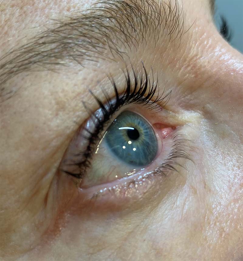 Lash Lift